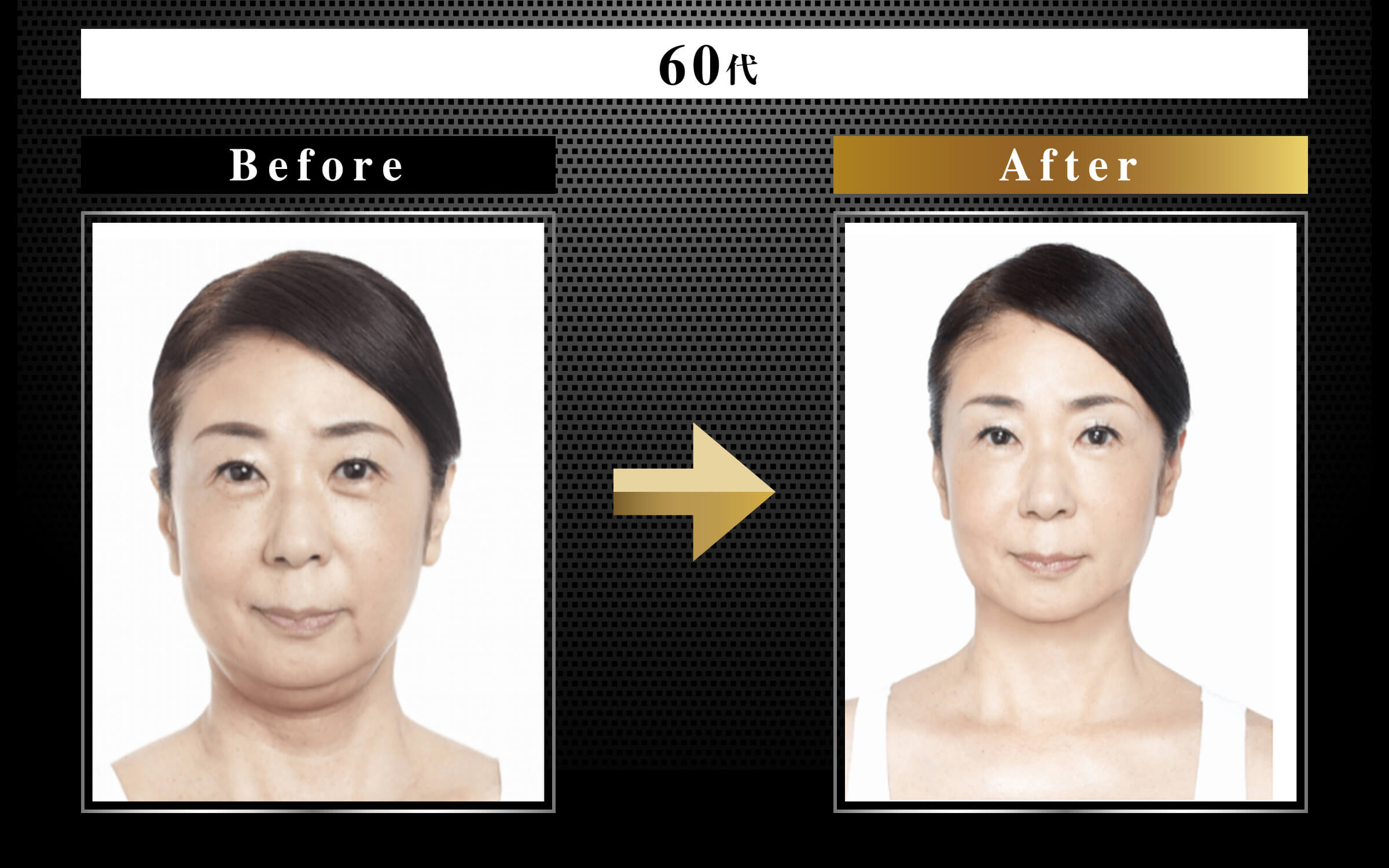 MIEKO メソッドの秘密
